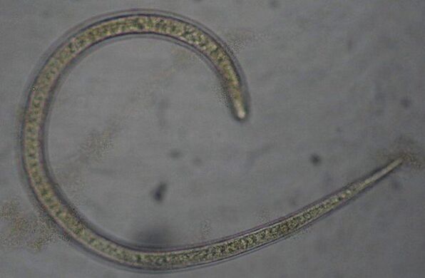 Трихинелата е протостомен кръгъл паразитен червей